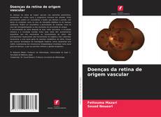 Buchcover von Doenças da retina de origem vascular
