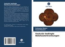 Bookcover of Vaskulär bedingte Netzhauterkrankungen