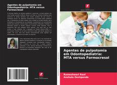 Couverture de Agentes de pulpotomia em Odontopediatria: MTA versus Formocresol