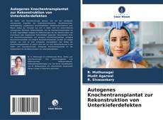 Capa do livro de Autogenes Knochentransplantat zur Rekonstruktion von Unterkieferdefekten 