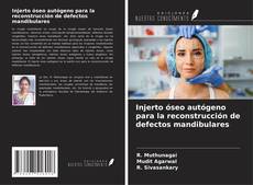 Bookcover of Injerto óseo autógeno para la reconstrucción de defectos mandibulares