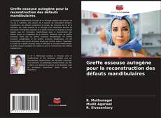 Buchcover von Greffe osseuse autogène pour la reconstruction des défauts mandibulaires