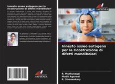 Bookcover of Innesto osseo autogeno per la ricostruzione di difetti mandibolari