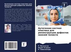 Bookcover of Аутогенная костная пластика для реконструкции дефектов нижней челюсти