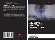 MULTISLICE TOMOGRAPHY WITH LOW RADIATION DOSE kitap kapağı
