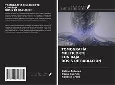 TOMOGRAFÍA MULTICORTE CON BAJA DOSIS DE RADIACIÓN kitap kapağı