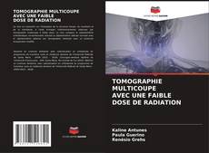 Bookcover of TOMOGRAPHIE MULTICOUPE AVEC UNE FAIBLE DOSE DE RADIATION