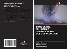 Bookcover of TOMOGRAFIA MULTISLICE CON UNA BASSA DOSE DI RADIAZIONI