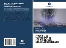 MULTISLICE-TOMOGRAPHIE MIT NIEDRIGER STRAHLENDOSIERUNG的封面