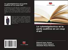 Buchcover von Le cytomégalovirus et la perte auditive en un coup d'œil