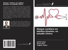 Bookcover of Ataque cardíaco en adultos jóvenes: un estudio clínico