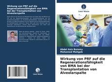 Capa do livro de Wirkung von PRF auf die Regenerationsfähigkeit von BMA bei der Transplantation von Alveolarspalte 