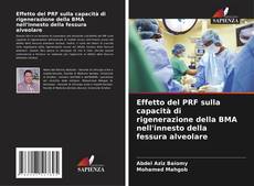 Bookcover of Effetto del PRF sulla capacità di rigenerazione della BMA nell'innesto della fessura alveolare