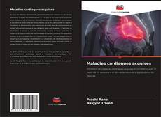 Buchcover von Maladies cardiaques acquises