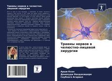 Buchcover von Травмы нервов в челюстно-лицевой хирургии