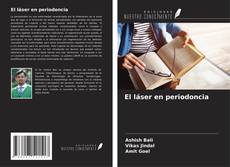 Bookcover of El láser en periodoncia
