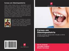 Bookcover of Coroas em Odontopediatria