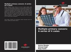 Bookcover of Multiple primary cancers: A series of 4 cases