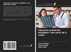 Bookcover of Cánceres primarios múltiples: una serie de 4 casos