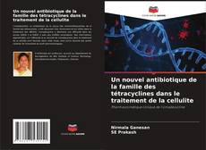 Portada del libro de Un nouvel antibiotique de la famille des tétracyclines dans le traitement de la cellulite