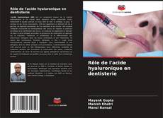 Buchcover von Rôle de l'acide hyaluronique en dentisterie