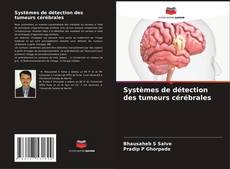 Couverture de Systèmes de détection des tumeurs cérébrales
