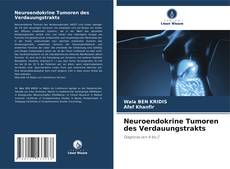 Capa do livro de Neuroendokrine Tumoren des Verdauungstrakts 