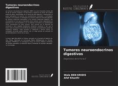 Bookcover of Tumores neuroendocrinos digestivos