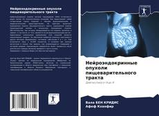 Bookcover of Нейроэндокринные опухоли пищеварительного тракта