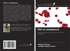 PRF en endodoncia的封面