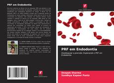 Borítókép a  PRF em Endodontia - hoz