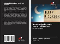 Bookcover of Apnea ostruttiva del sonno nei bambini