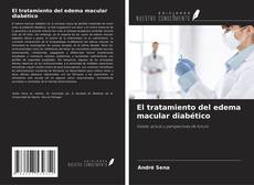Buchcover von El tratamiento del edema macular diabético