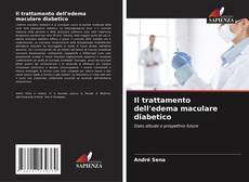 Bookcover of Il trattamento dell'edema maculare diabetico