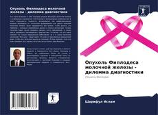 Bookcover of Опухоль Филлодеса молочной железы - дилемма диагностики