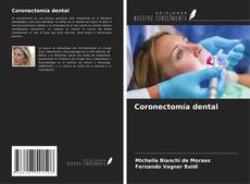Buchcover von Coronectomía dental