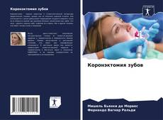 Bookcover of Коронэктомия зубов