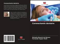 Buchcover von Coronectomie dentaire