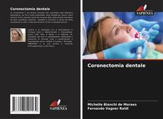 Bookcover of Coronectomia dentale