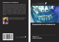 Couverture de Expansión en ortodoncia