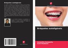 Bookcover of Bráquetes autoligáveis