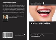Bookcover of Brackets autoligables