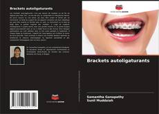 Copertina di Brackets autoligaturants