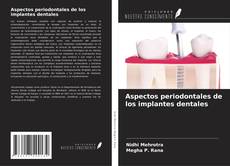 Bookcover of Aspectos periodontales de los implantes dentales