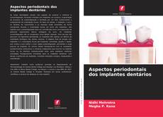 Portada del libro de Aspectos periodontais dos implantes dentários