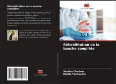 Bookcover of Réhabilitation de la bouche complète