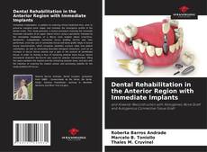 Buchcover von Dental Rehabilitation in the Anterior Region with Immediate Implants