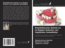 Capa do livro de Rehabilitación Dental en la Región Anterior con Implantes Inmediatos 