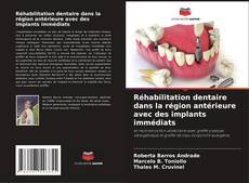 Capa do livro de Réhabilitation dentaire dans la région antérieure avec des implants immédiats 