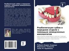 Bookcover of Реабилитация зубов в переднем отделе с помощью немедленных имплантатов